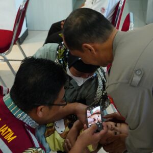 Bakti Kesehatan Polres Ponorogo Gelar Screening Katarak dan Bibir Sumbing