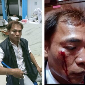 Ketua IWO  Indonesia Jombang: Kecam Keras Pelaku Penganiaya Kipri Herdiansyah